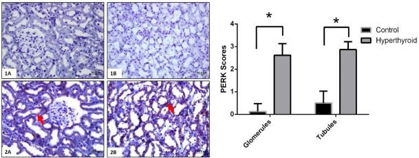 Cistanche-kidney Cistanche-kidney