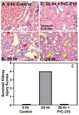 Figure 2. Histology of (A) BN kidney upon removal from BN rat. (B–D) BN kidneys 20 h following  transplant into LEW rats