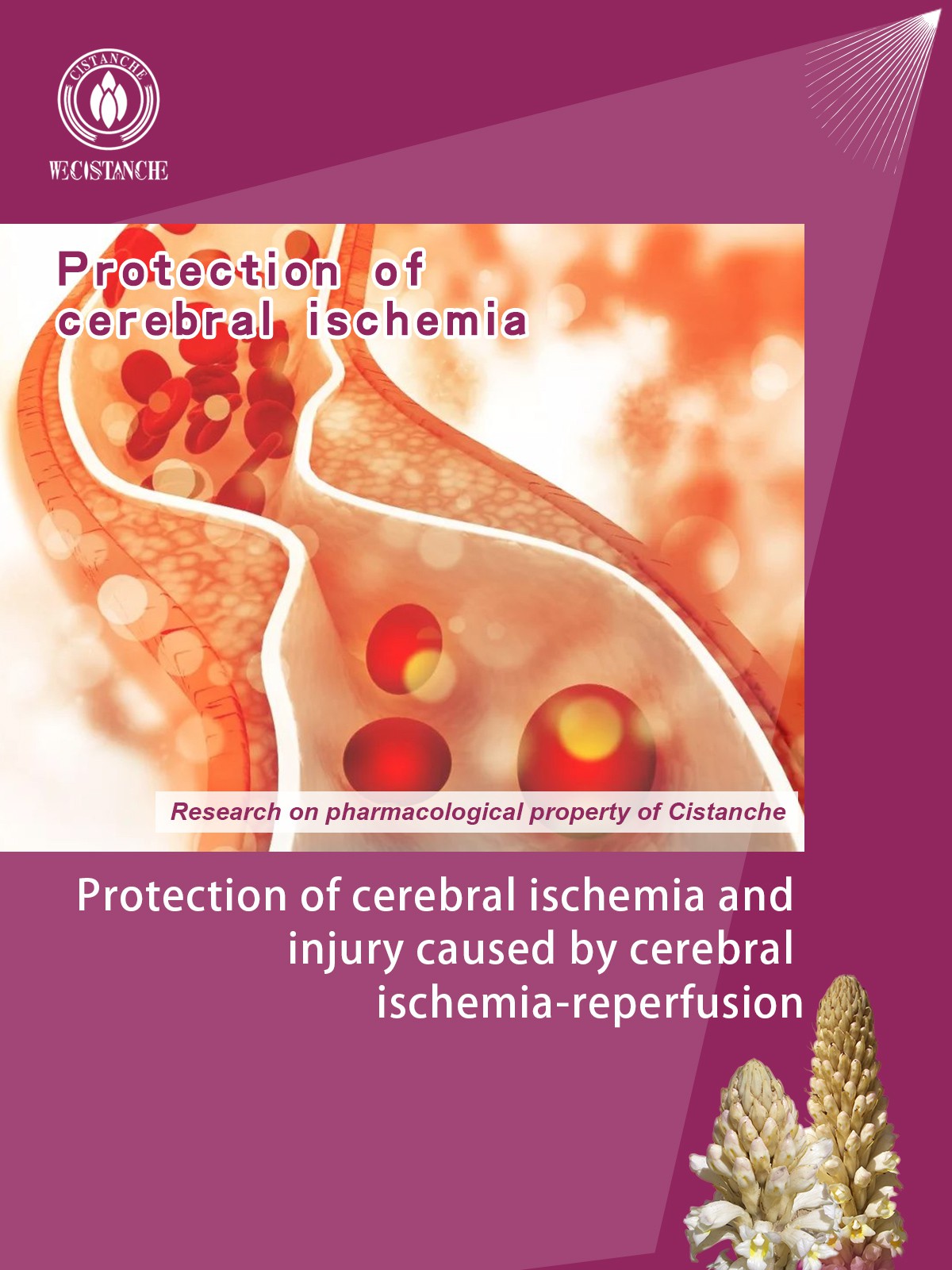 Protection of cerebral ischemia