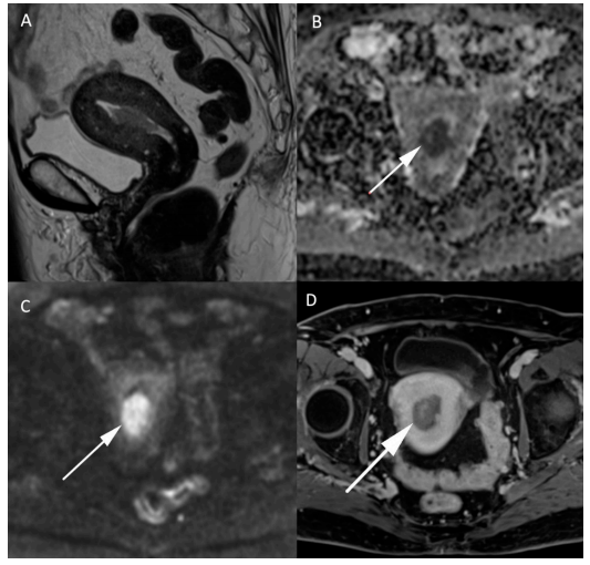 Figure 3 Figure 3
