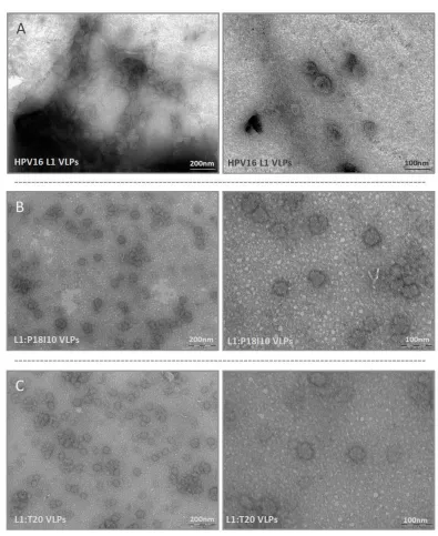 Figure 4. Electron micrographs of L1:P18I10 and L1:T20 VLPs. (A) Morphology of HPV16 VLPs. (B) Morphology of L1:P18I10 VLPs. (C) Morphology of L1:T20 VLPs. Purified VLPs were absorbed on UV-charged carbon-coated copper grids, and negatively stained with 2% uranyl acetate. Images were acquired under transmission electron microscopy. The bar represents 200 nm at magnification 59,000 (left panel) and 100 nm at magnification 135K (right panels), respectively