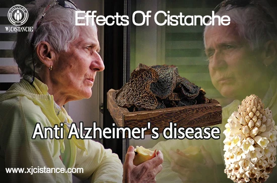 Anti Alzheimer's disease